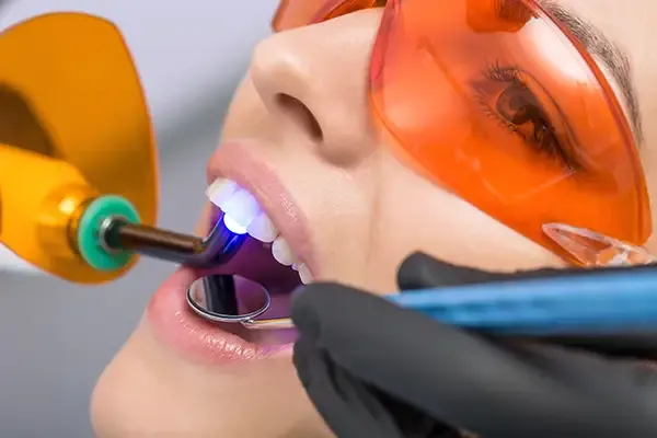 A dentist applying a curing light during a dental bonding procedure while the patient wears protective orange glasses.