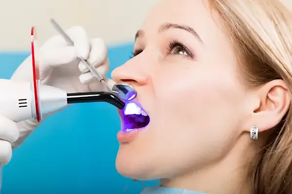 A female patient undergoing dental bonding as a dentist uses a curing light to harden the resin material on her teeth.