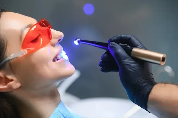 A dentist curing a dental sealant on an adult female patient’s teeth with a blue light, while the patient wears red protective glasses.