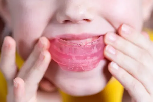 Close-up of a young girl placing a protective pink sports guard in her mouth.