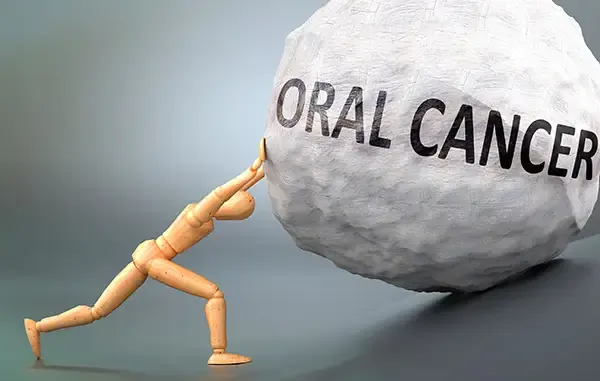 Wooden mannequin pushing a large boulder labeled "Oral Cancer," symbolizing the challenges of oral cancer awareness and prevention.